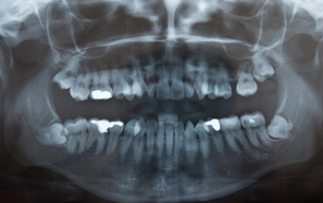 口腔外科の診療領域